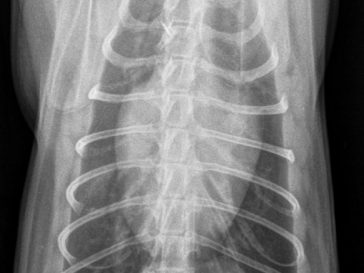 «Valentins-Herz»: Ventro-dorsale Aufnahme mit vergrösserter Herz- Silhouette