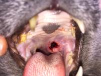 Tumor im Rachen