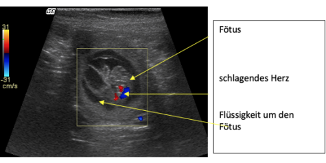 Ultraschallbild einer trächtigen Hündin