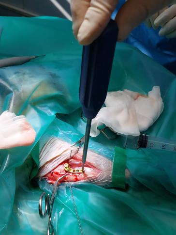Während der Operation ist gerade bei kleinen Patienten ein hohes Mass an Präzision gefragt.