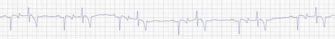 EKG Pferde Telemetrie