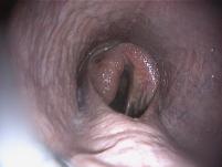 Laryngoskopie Pferde