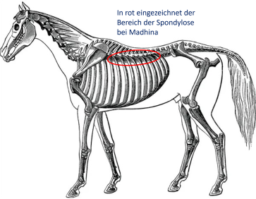 Schematische Darstellung der betroffenen Wirbelkörper der Brustwirbelsaule