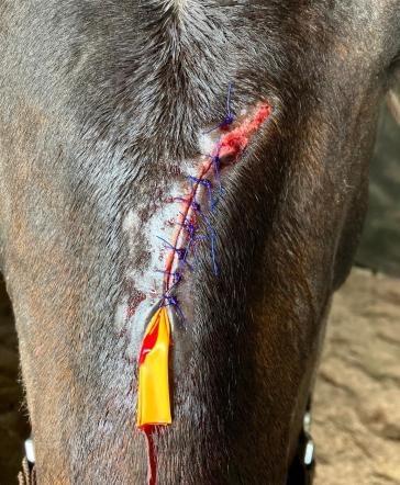 Eine primär verschlossene Wunde am Kopf mit eingelegter Drainage.