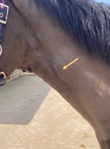 Wundnaht nach Verschluss der Blutgefässe