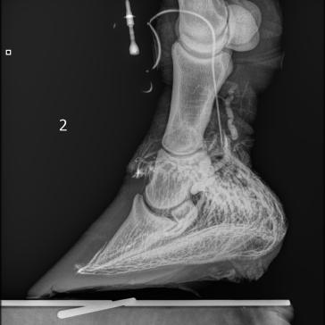 Venogramm 2