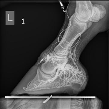 Venogramm 3