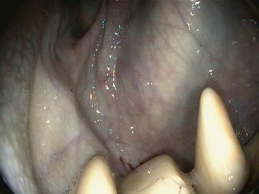 Chondroiten im Luftsack