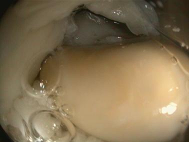 Chondroit im Luftsack