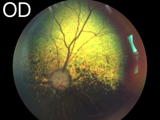 Ophthalmologie